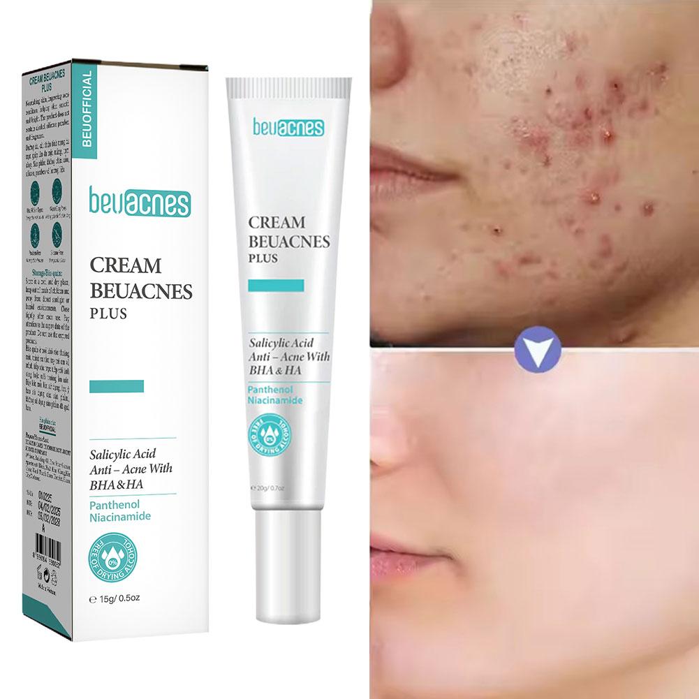 Skincare Salicylic Acid - 새로운 20g 니아신 아미드 여드름 젤