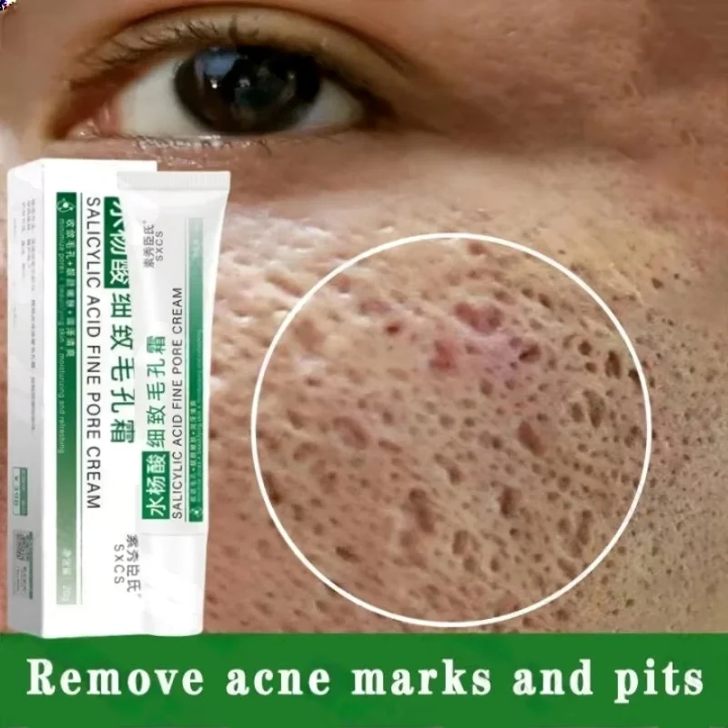 Azelaic Acid Cream - 살리실산 모공 클리어링 크림 모공 축소