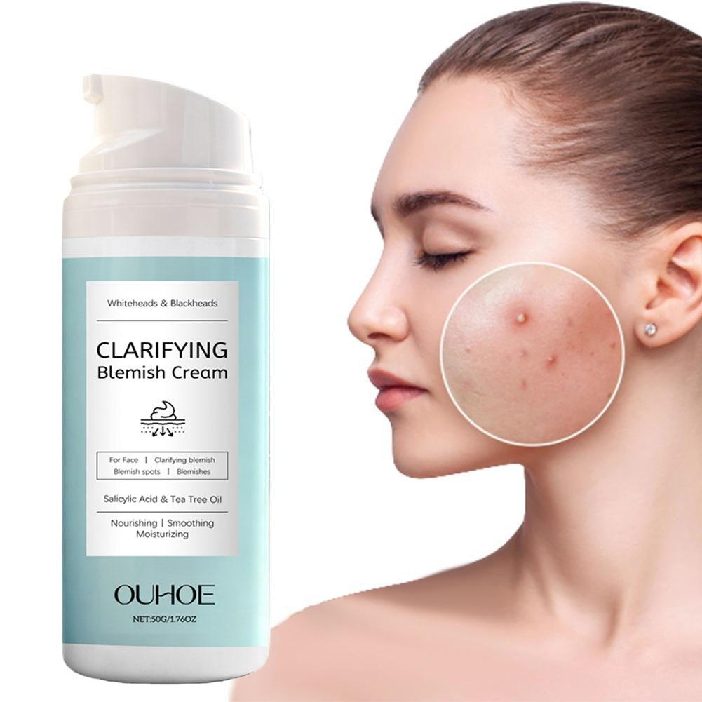 Azelaic Acid Cream - 여드름 피부용 살리실산 페이셜 크림, 유분