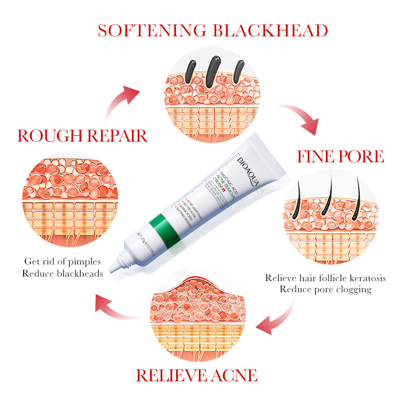 1/2/3pcs BIOAQUA 살리실산 페이스 크림 여 - Azelaic Acid Cream 리뷰 및 가격