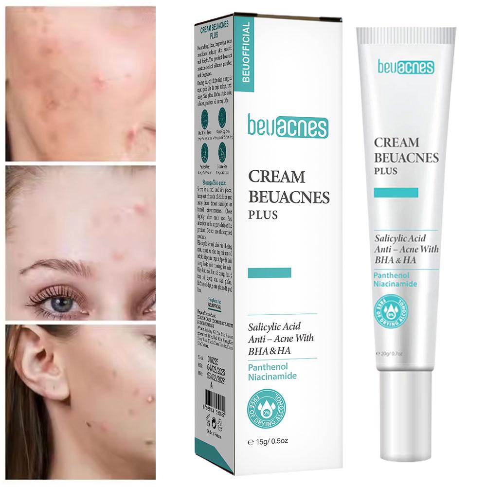 새로운 20g 니아신 아미드 여드름 젤 안티 여드름 살 - Skincare Salicylic Acid 리뷰 및 가격