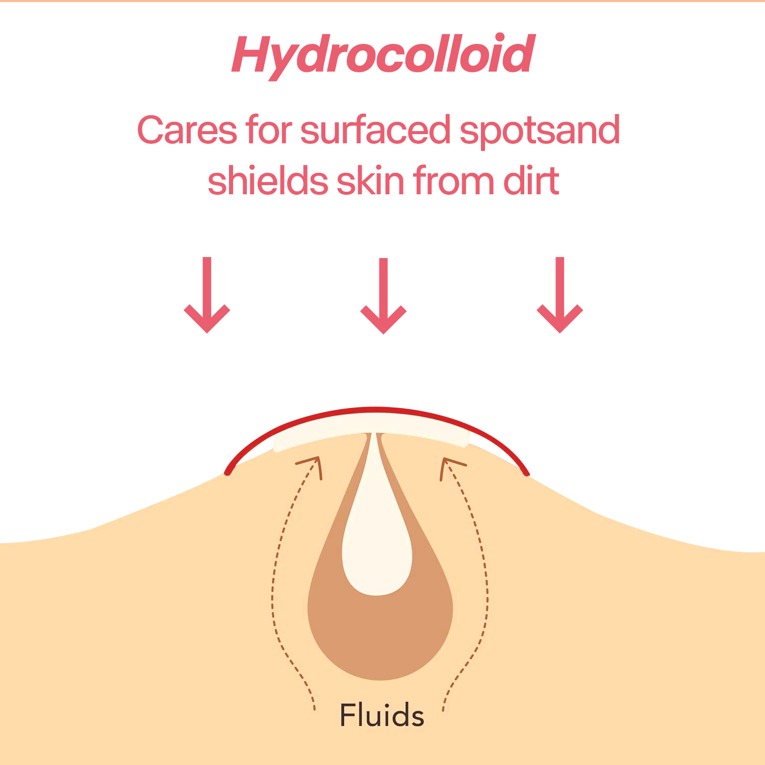 216개 살리실산 여드름 패치 빠른 여드름 및 블랙헤드 - Skincare Salicylic Acid 리뷰 및 가격