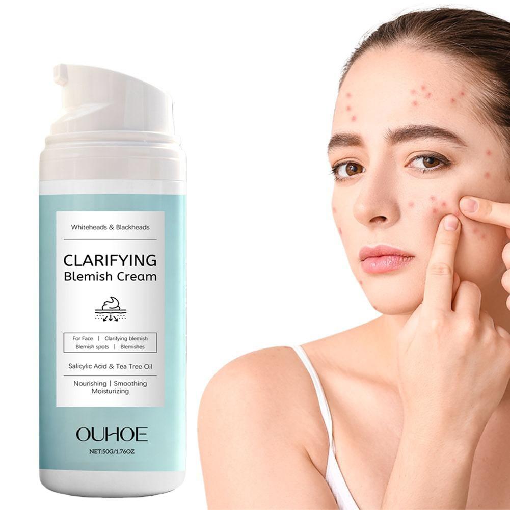여드름 피부용 살리실산 페이셜 크림, 유분 조절, 진정 - Azelaic Acid Cream 리뷰 및 가격