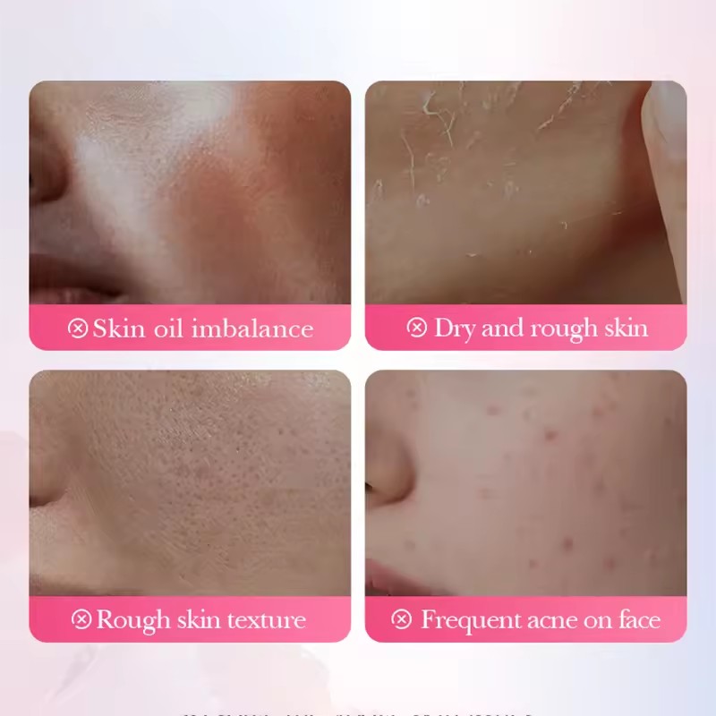 사도어 사쿠라 살리실산 페이스 마스크 보습 여드름 방지 - Skincare Salicylic Acid 리뷰 및 가격