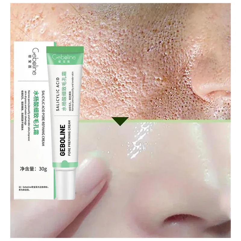 살리실산 모공 수축 크림, 빠른 제거, 큰 모공 제거, - Skincare Salicylic Acid 리뷰 및 가격