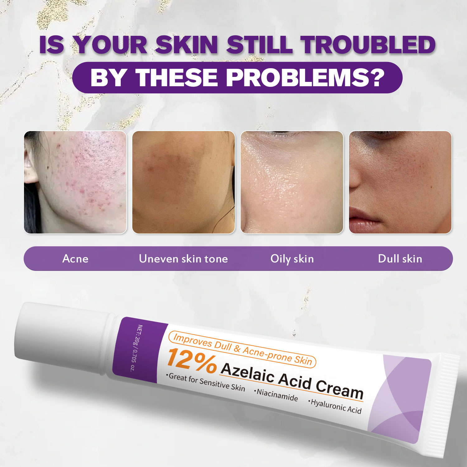 순한 아젤라산 크림은 칙칙한 피부를 개선하고 거친 피부 - Azelaic Acid Cream 리뷰 및 가격