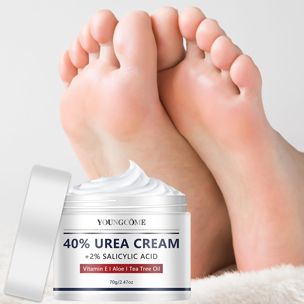 우레아 크림 발 손 관리 |   40% 우레아 + 2% - Azelaic Acid Cream 리뷰 및 가격