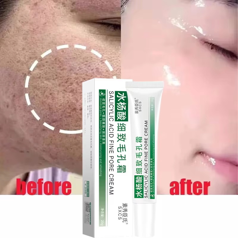 살리실산 모공 축소 크림 빠른 모공 축소 블랙헤드 제거 - Skincare Salicylic Acid 리뷰 및 가격