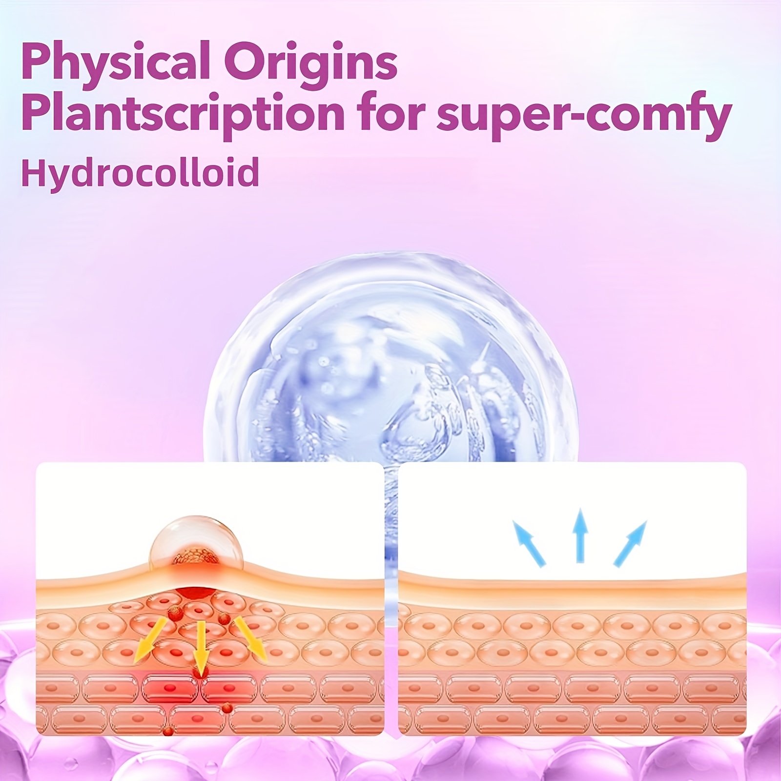 432개/박스 여드름 패치, 무자극 여드름 스티커, 고 - Azelaic Acid Cream 리뷰 및 가격
